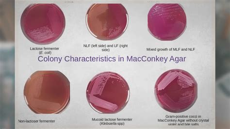 EMB Agar: Composition, Principle, and Colony Morphology.